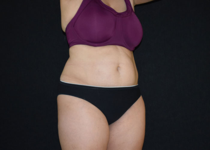 Woman wearing purple bra and black panties, midsection close-up against a black background. Saxon MD