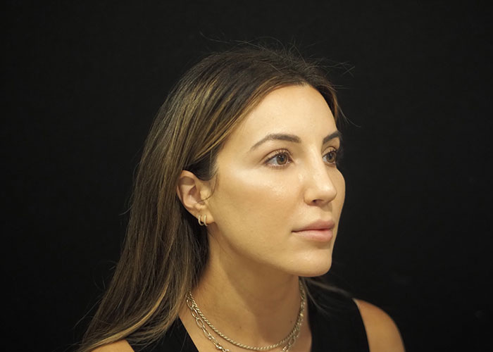 Side profile of a woman with dark hair wearing a necklace, against a black background. Saxon MD