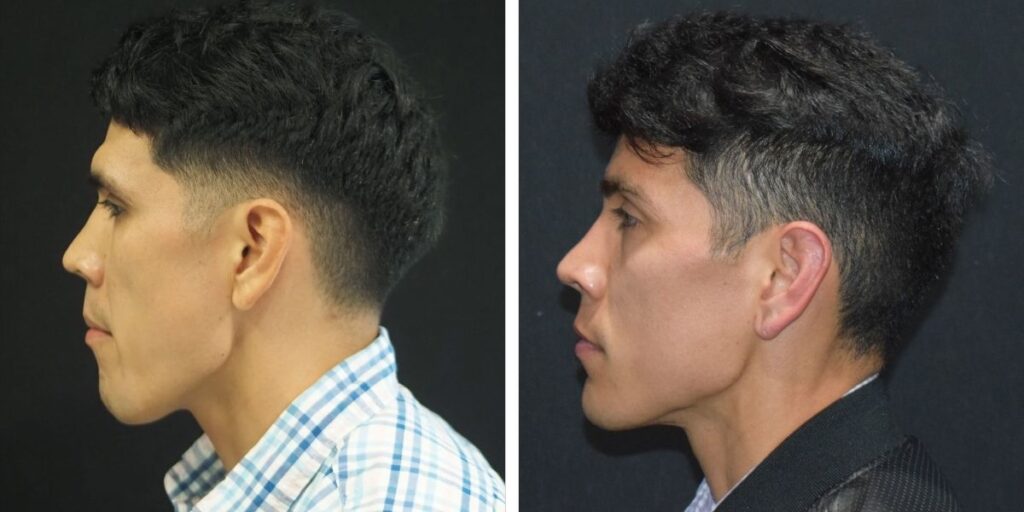 Side profile views of a man with a modern hairstyle before and after a haircut, showcasing a neat trim and styled waves. Saxon MD
