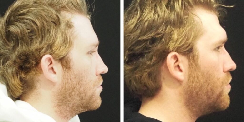 Side-by-side images of a man with curly blond hair, seen in profile, one from the left side and one from the right side. Saxon MD