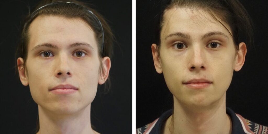 Side-by-side headshots of the same person with and without makeup, showing a clear complexion and styled hair pulled back. Saxon MD