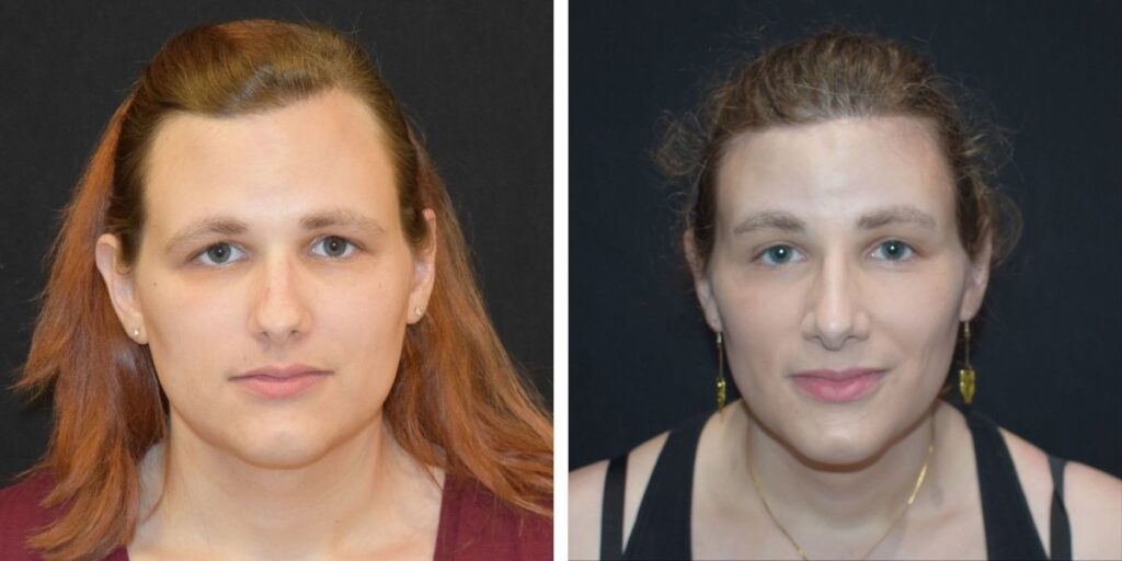 Side-by-side portraits of the same person, one with makeup and earrings on the right, and the other without on the left, against a black background. Saxon MD