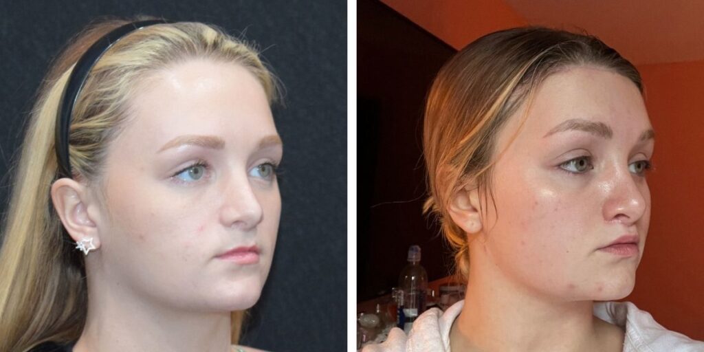 Side-by-side comparison of a woman's face before and after applying makeup, focusing on her clear complexion and enhanced features. Saxon MD