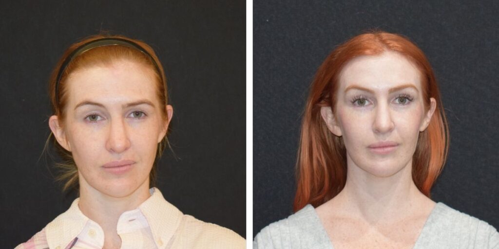 Two side-by-side portraits of the same woman with red hair, one before and one after a makeover, against a black background. Saxon MD