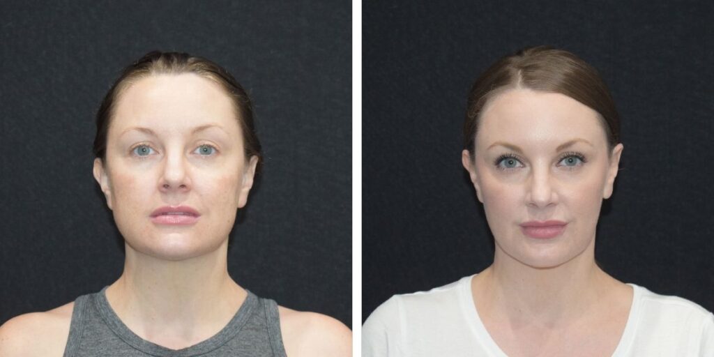 Before and after photos of a woman with makeup, showcasing a transformation from a bare face to a fully made-up appearance, against a plain background. Saxon MD