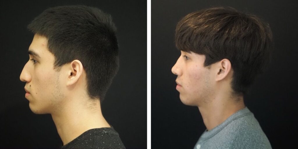 Side profiles of two young men with different hairstyles against a black background. Saxon MD