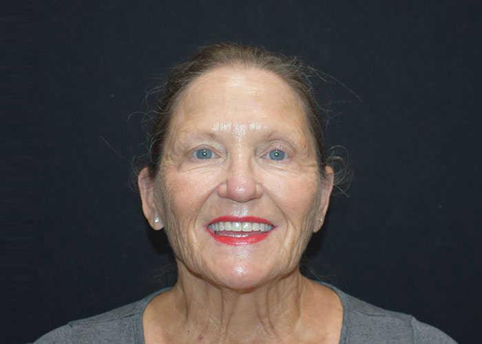 An elderly woman with a warm smile, wearing red lipstick and a gray top, against a black background. Saxon MD