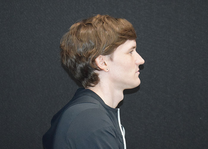 Side profile of a person with short brown hair wearing a dark jacket, against a black background. Saxon MD