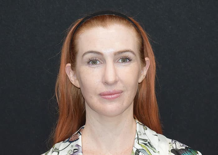 A woman with red hair styled in a ponytail, wearing a patterned blouse and a headband, poses against a black background. Saxon MD