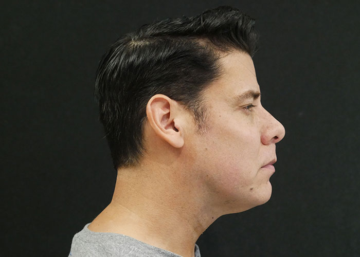 Profile view of a middle-aged man with dark hair, wearing a gray shirt, against a black background. Saxon MD
