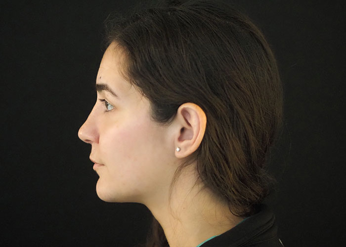 Side profile of a young woman against a black background. Saxon MD