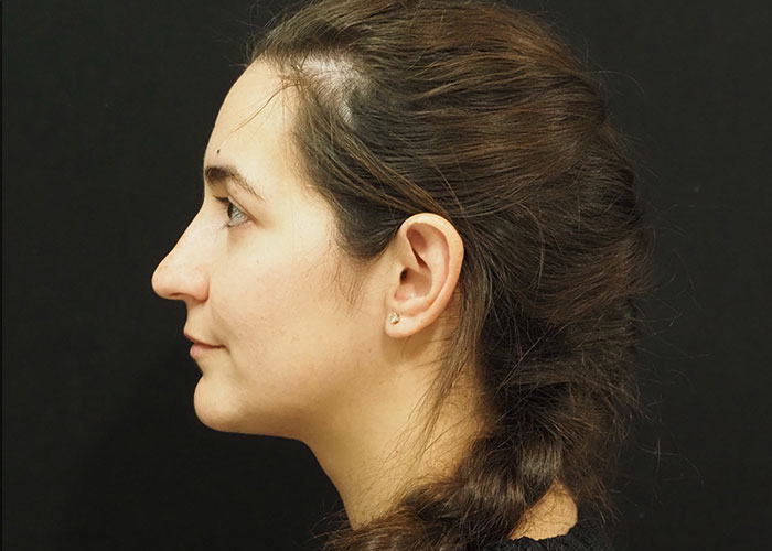Profile view of a woman with medium-length hair tied in a braid, against a black background. Saxon MD