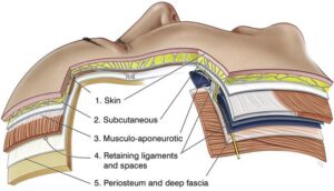 diagram of facial layers to explain a SMAS facelift