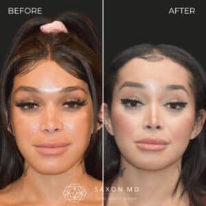 Copy of Copy of Before & After Vertical  - 1