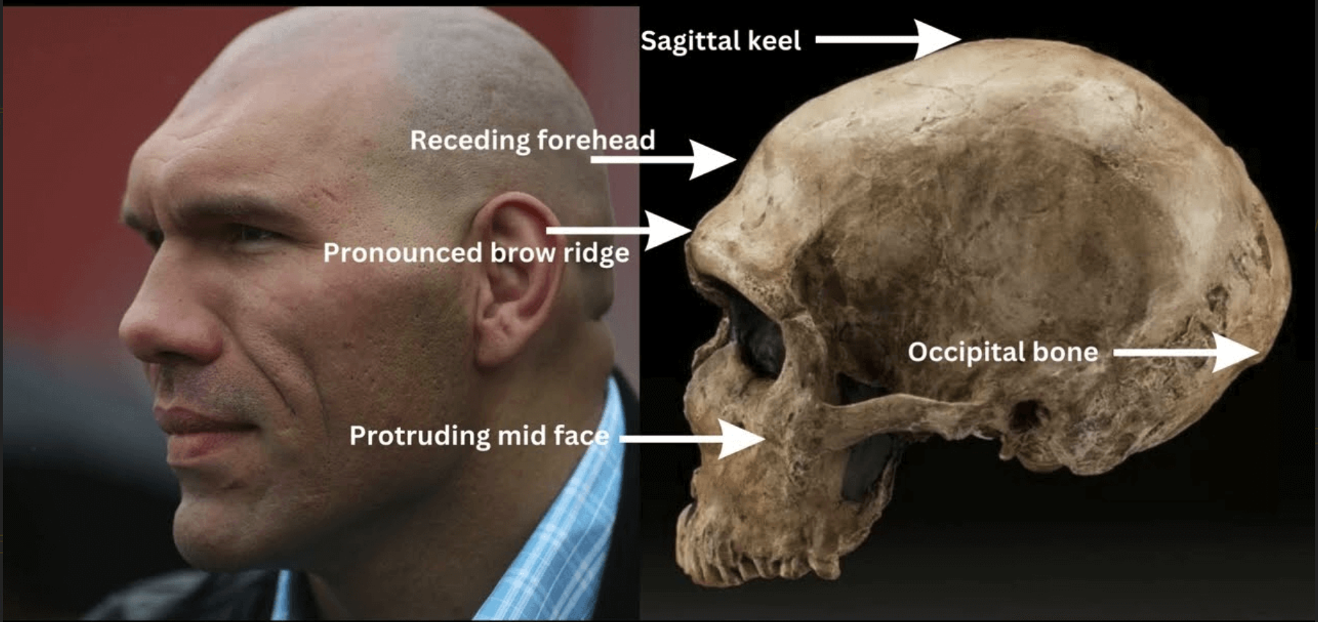 Unveiling The Testosterone Brow Ridge Connection Fact Or Fiction - xxnr4u4