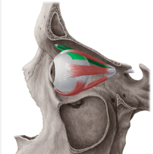 diagram of superior oblique muscle and trochlea to explain diplopia as one of the rare brow bone reduction complications