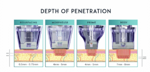 rf microneedling devices - morpheus8