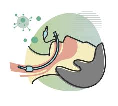 general anesthesia vs sedation