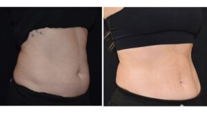 semaglutide chicago medspa TOP 10 BEST Semaglutide in Chicago, IL - Updated 2026 - Quality &  Affordability