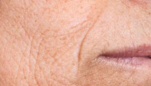 skin texture on the face - wrinkles