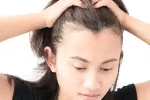 m shaped hairline
