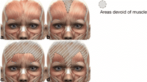 frontalis muscle, forehead muscles