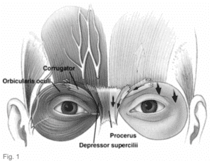 corrugator muscle, forehead muscles