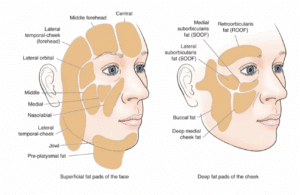 ozempic face, orbital bone, fat pads of the face
