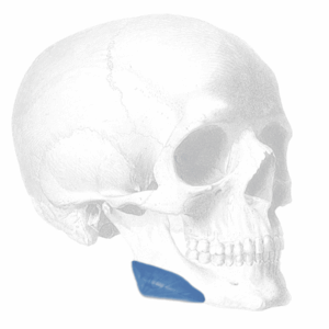 jaw angle implants
